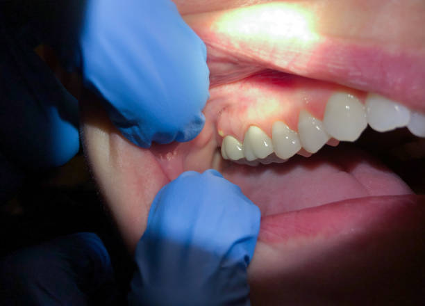 Best Dentist for Dental Trauma  in Worcester, MA