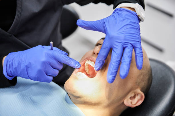 Best Emergency Dental Filling Replacement  in Worcester, MA