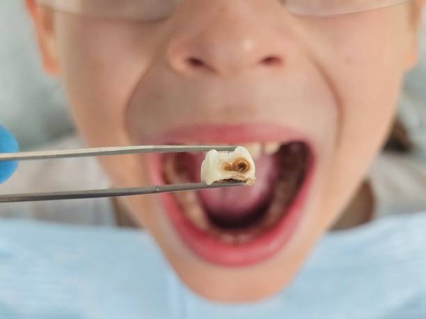 Best Emergency Pediatric Dentist  in Worcester, MA